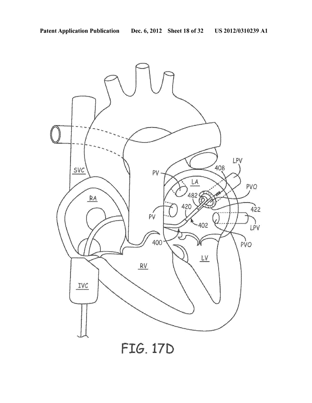 Ablation Catheters and Associated Systems and Methods - diagram, schematic, and image 19