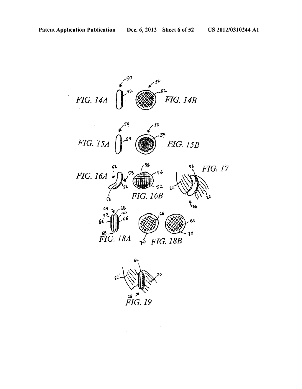 METHOD OF USING A VERTEBRAL FACET JOINT DRILL - diagram, schematic, and image 07