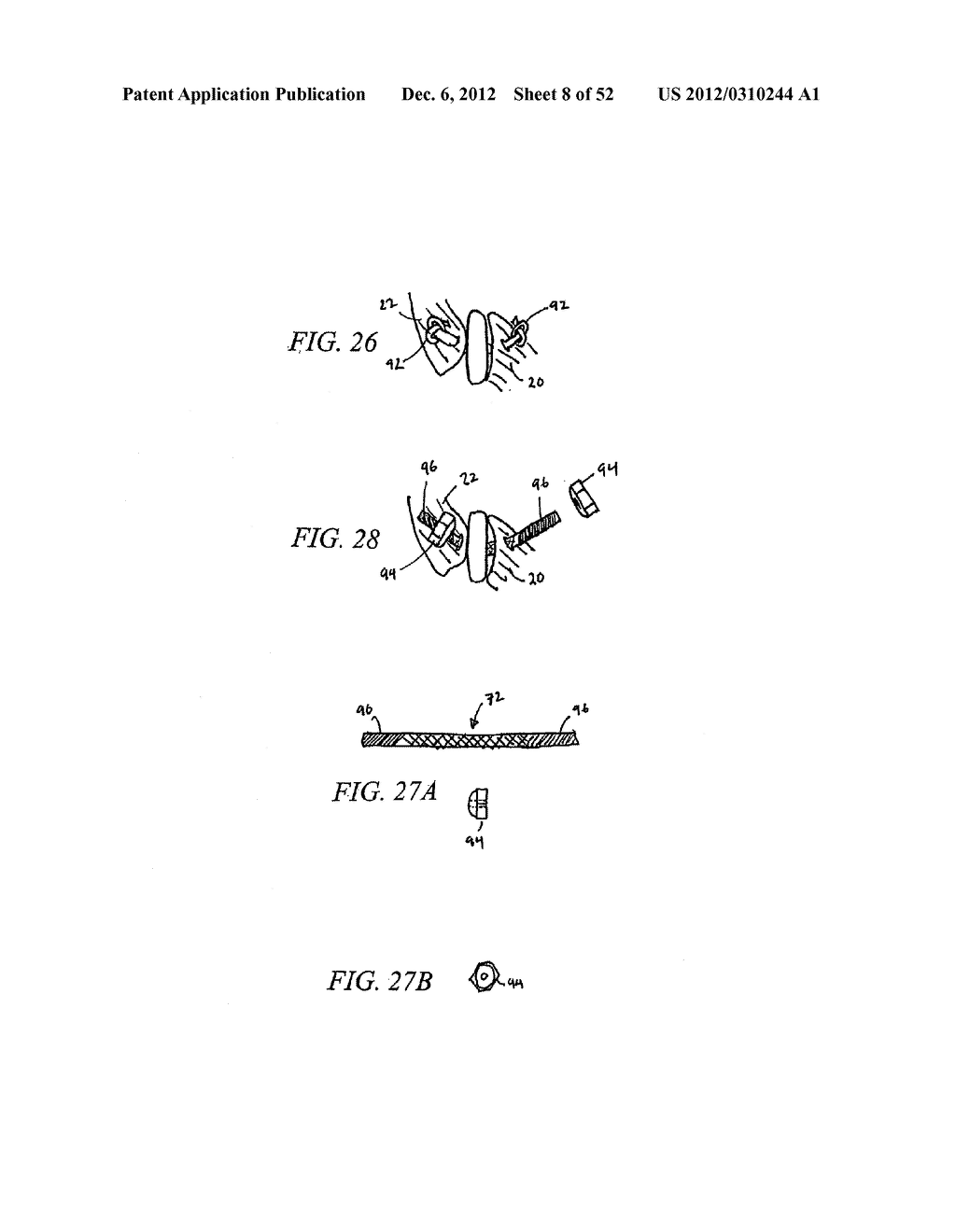 METHOD OF USING A VERTEBRAL FACET JOINT DRILL - diagram, schematic, and image 09