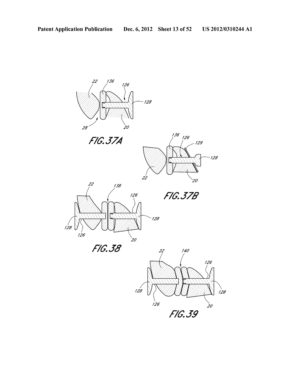 METHOD OF USING A VERTEBRAL FACET JOINT DRILL - diagram, schematic, and image 14