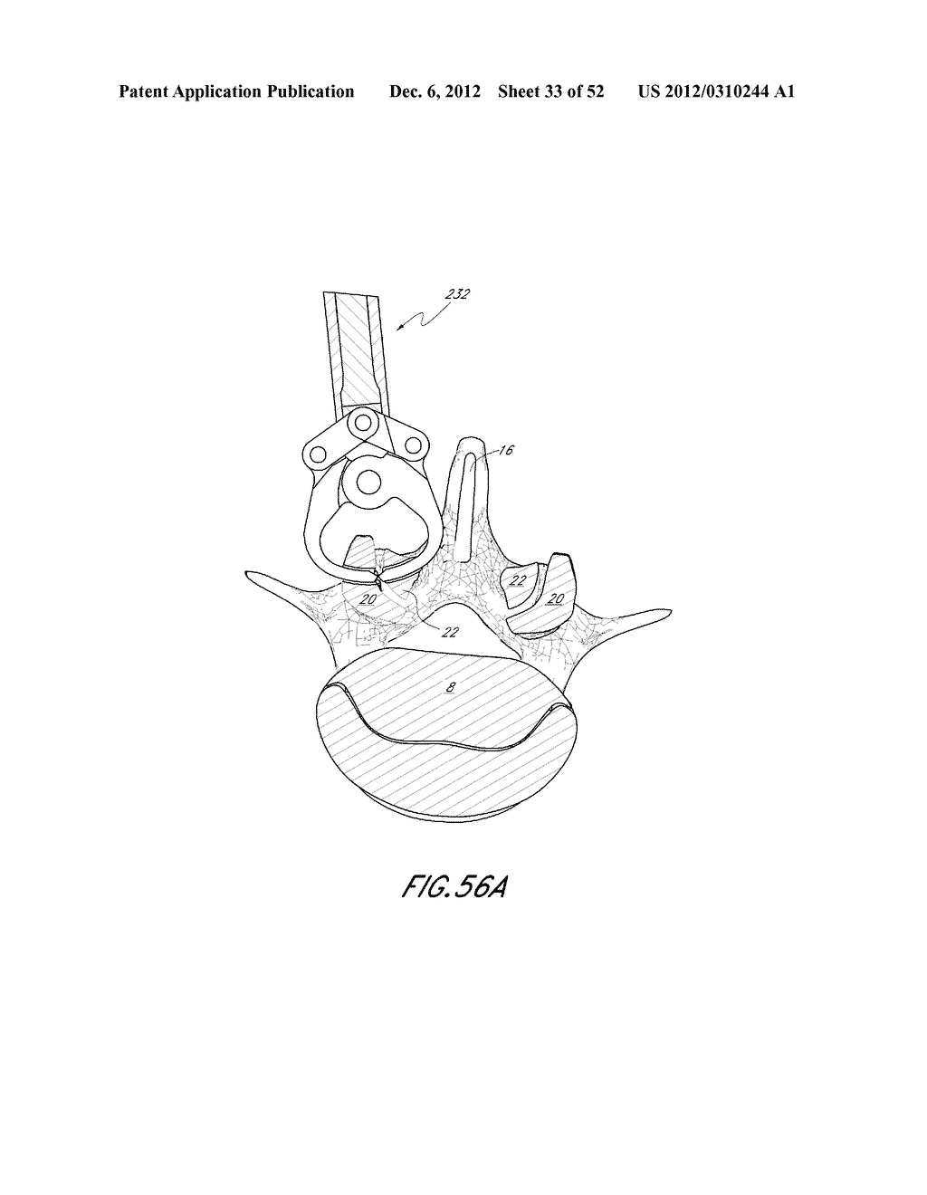 METHOD OF USING A VERTEBRAL FACET JOINT DRILL - diagram, schematic, and image 34