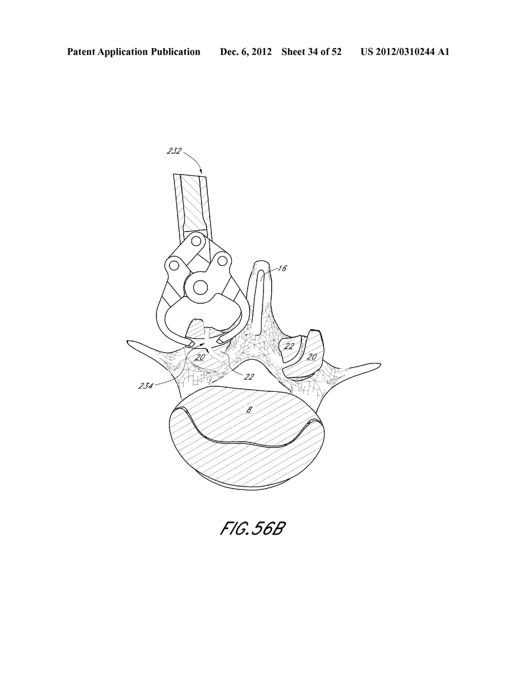 METHOD OF USING A VERTEBRAL FACET JOINT DRILL - diagram, schematic, and image 35