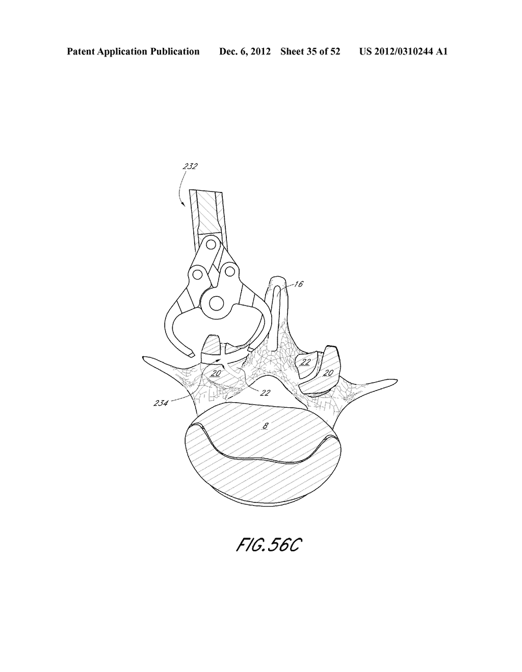 METHOD OF USING A VERTEBRAL FACET JOINT DRILL - diagram, schematic, and image 36