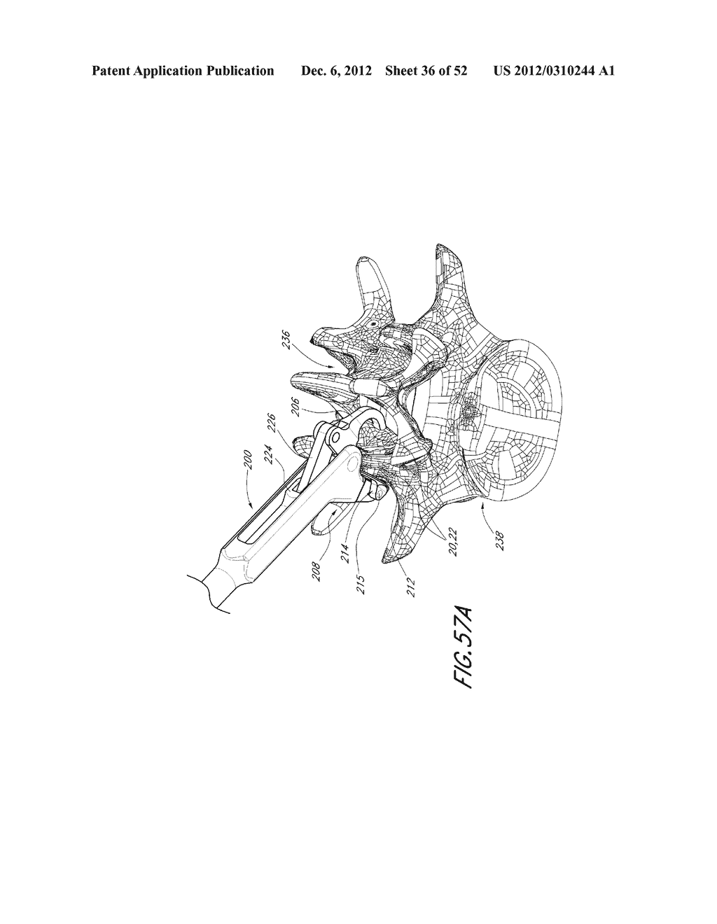 METHOD OF USING A VERTEBRAL FACET JOINT DRILL - diagram, schematic, and image 37