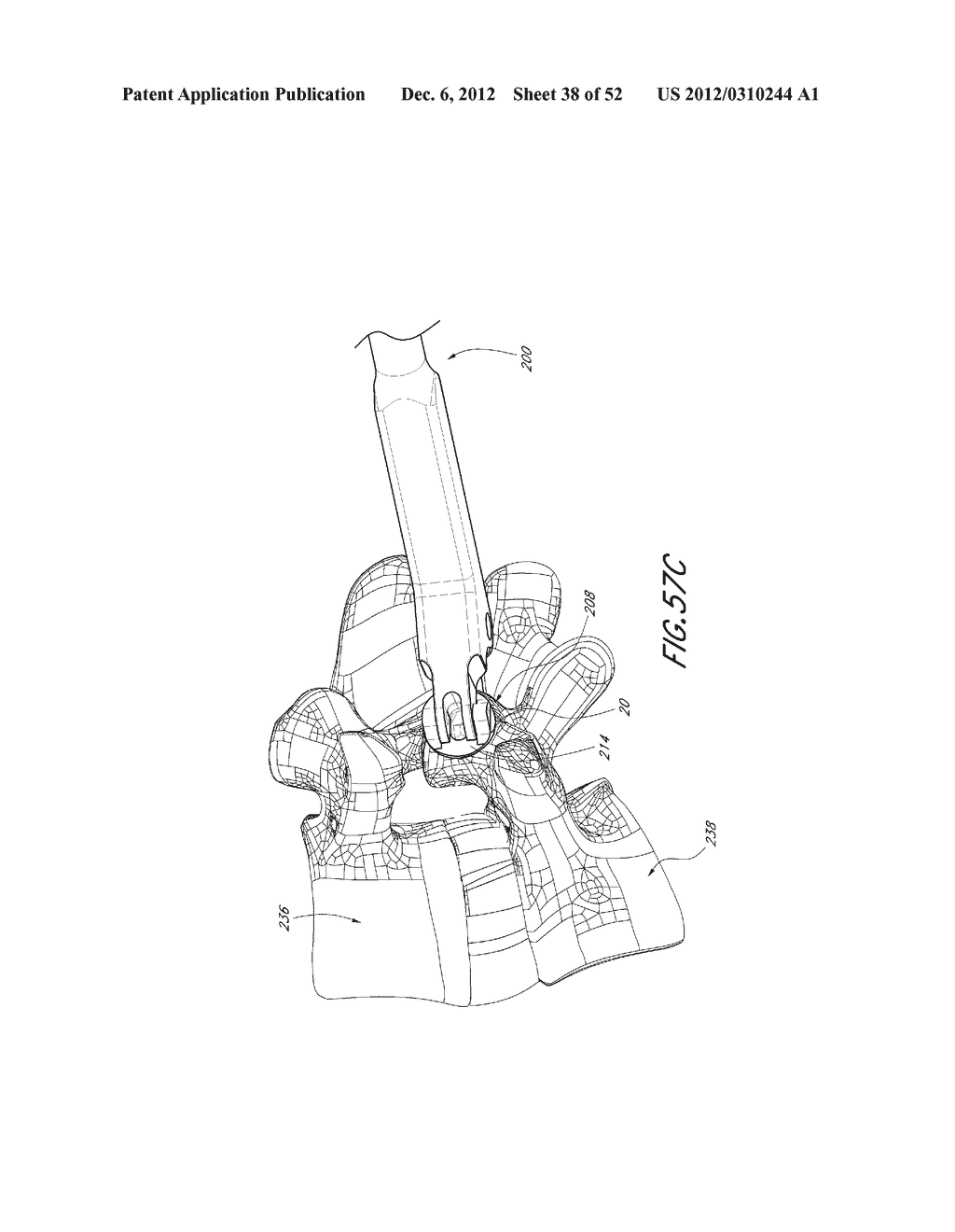 METHOD OF USING A VERTEBRAL FACET JOINT DRILL - diagram, schematic, and image 39
