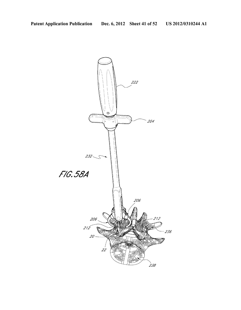 METHOD OF USING A VERTEBRAL FACET JOINT DRILL - diagram, schematic, and image 42