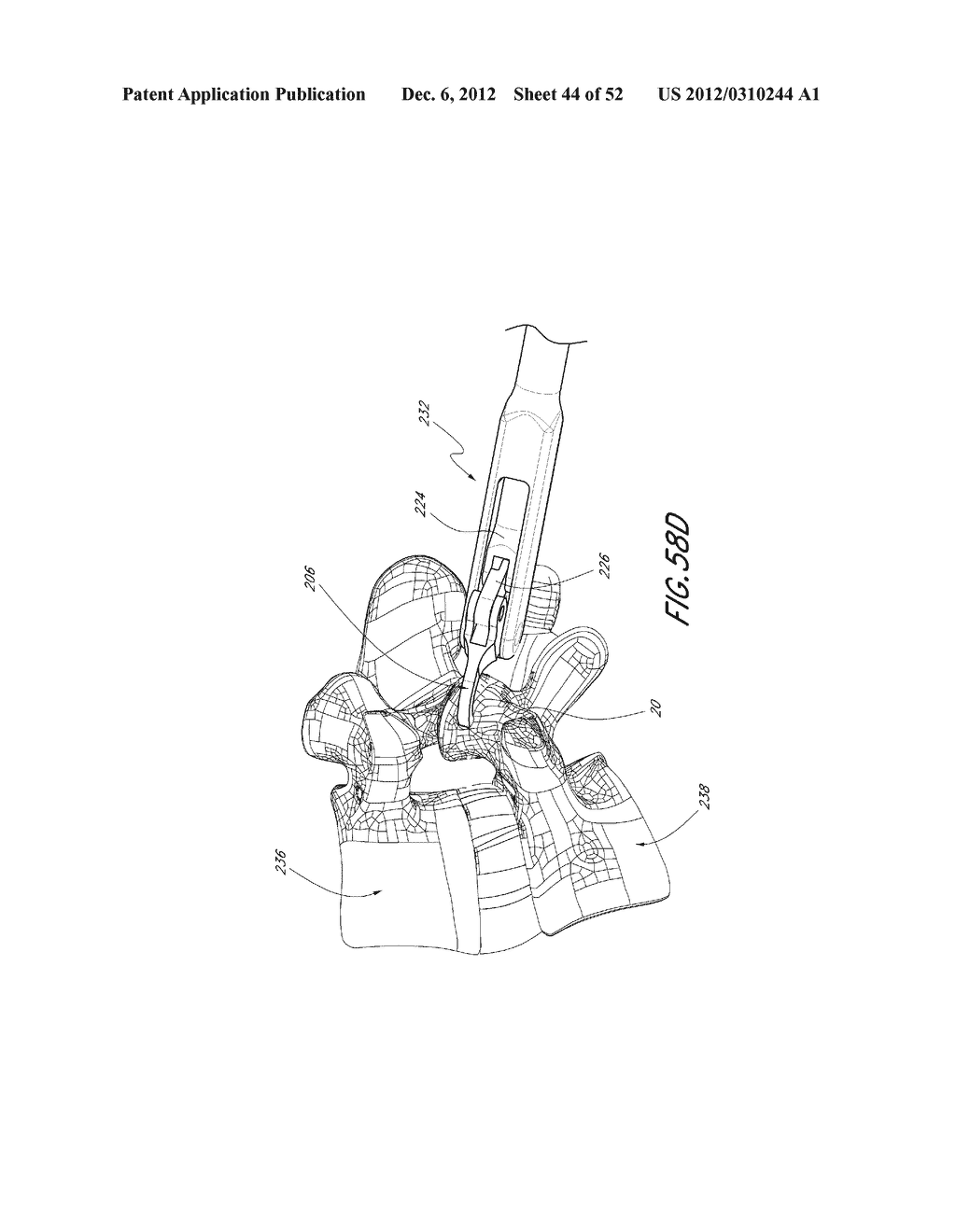 METHOD OF USING A VERTEBRAL FACET JOINT DRILL - diagram, schematic, and image 45