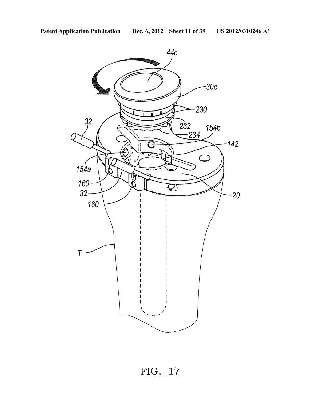 Method And Apparatus For Implanting A Knee Prosthesis - diagram, schematic, and image 12