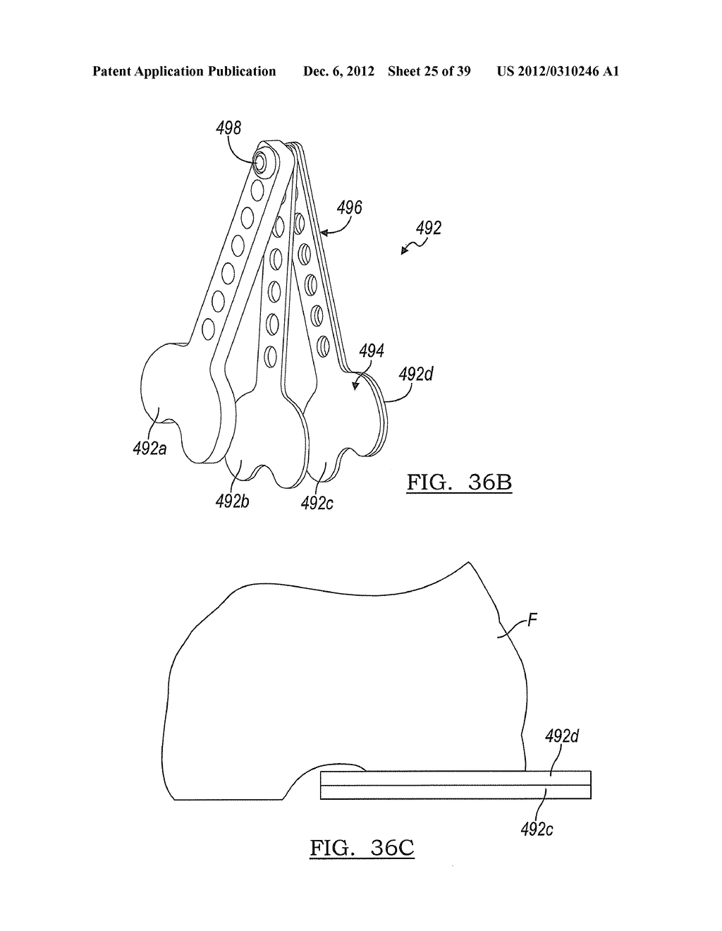 Method And Apparatus For Implanting A Knee Prosthesis - diagram, schematic, and image 26