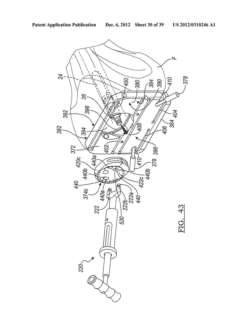 Method And Apparatus For Implanting A Knee Prosthesis - diagram, schematic, and image 31
