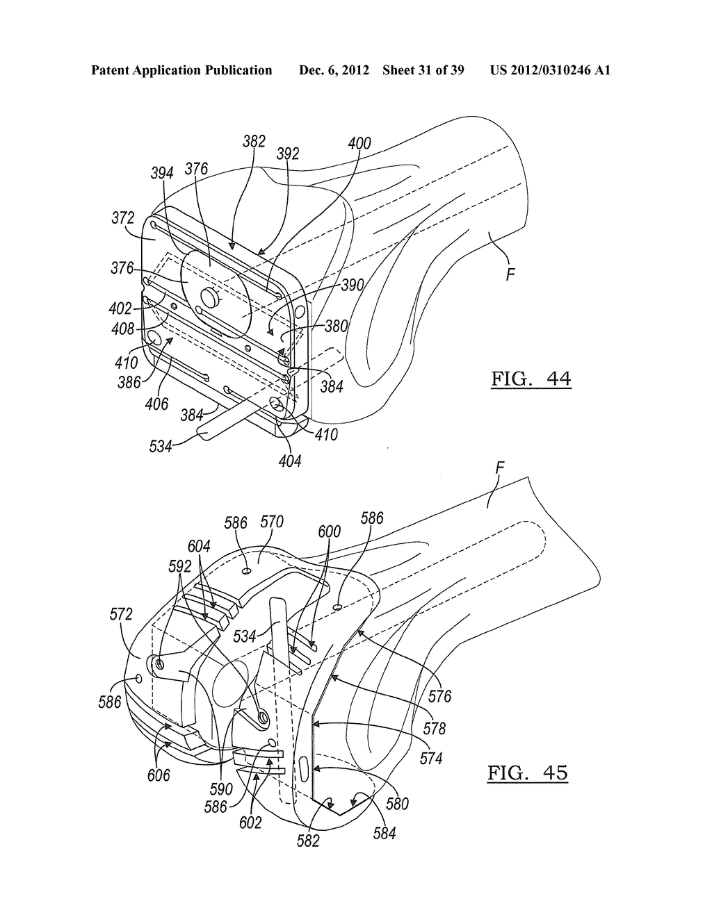 Method And Apparatus For Implanting A Knee Prosthesis - diagram, schematic, and image 32