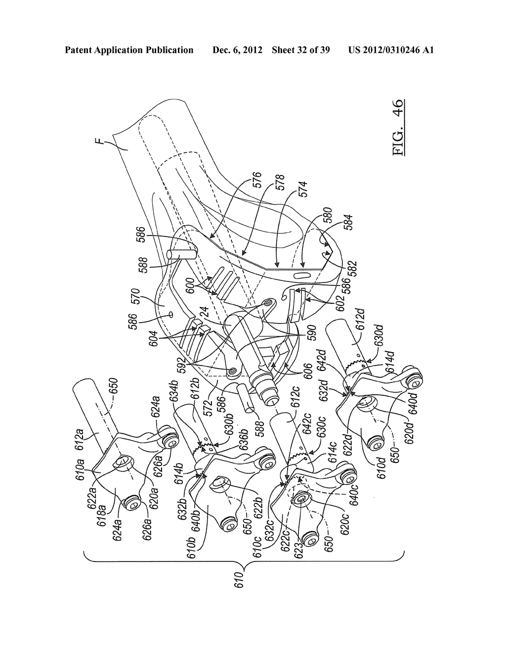 Method And Apparatus For Implanting A Knee Prosthesis - diagram, schematic, and image 33