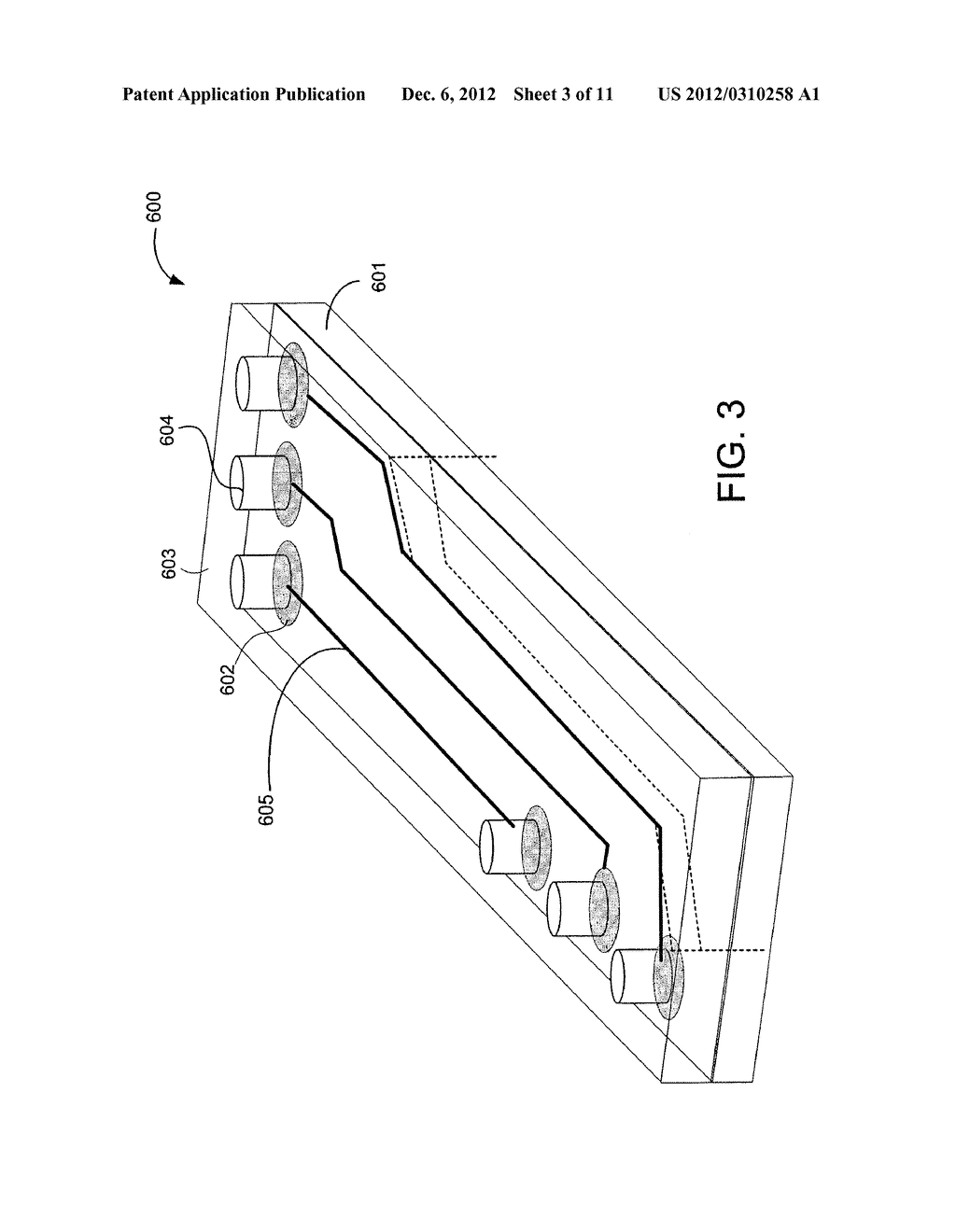 COCHLEAR IMPLANT WITH IMPROVED ELECTRODE ARRAY AND CONTROLLER - diagram, schematic, and image 04