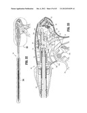 ENDOSCOPIC SURGICAL CLIP APPLIER diagram and image