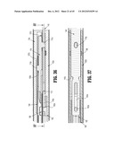 ENDOSCOPIC SURGICAL CLIP APPLIER diagram and image