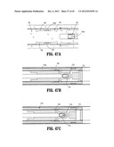 ENDOSCOPIC SURGICAL CLIP APPLIER diagram and image