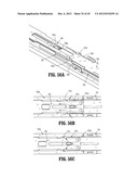 ENDOSCOPIC SURGICAL CLIP APPLIER diagram and image