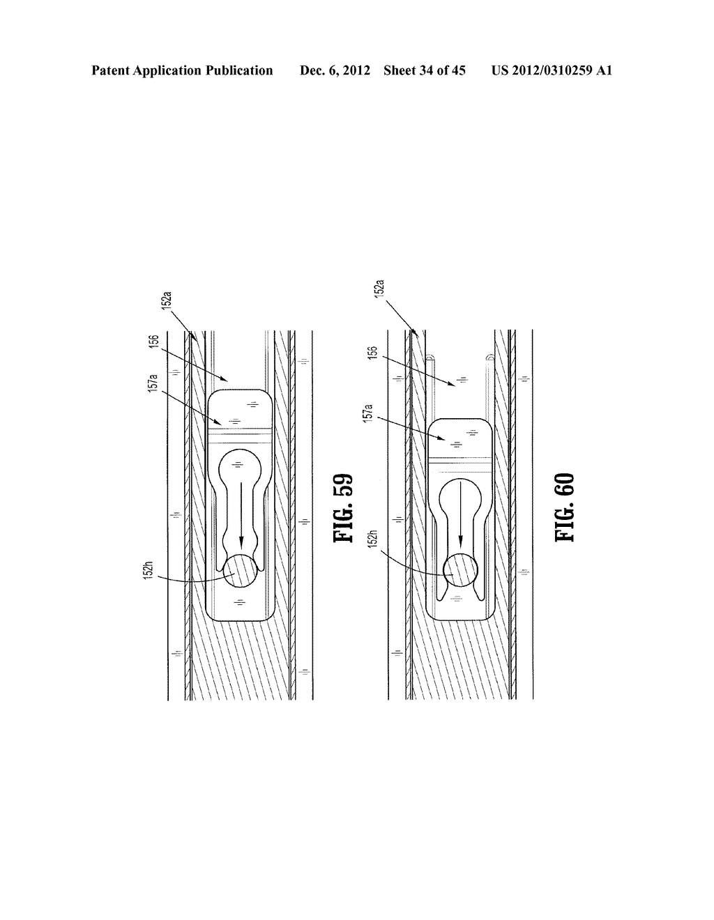 ENDOSCOPIC SURGICAL CLIP APPLIER - diagram, schematic, and image 35