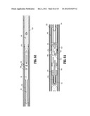 ENDOSCOPIC SURGICAL CLIP APPLIER diagram and image