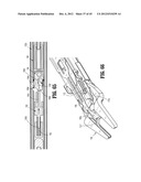 ENDOSCOPIC SURGICAL CLIP APPLIER diagram and image