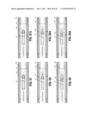 ENDOSCOPIC SURGICAL CLIP APPLIER diagram and image