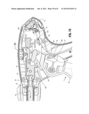 ENDOSCOPIC SURGICAL CLIP APPLIER diagram and image