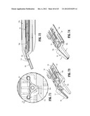 ENDOSCOPIC SURGICAL CLIP APPLIER diagram and image