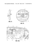 ENDOSCOPIC SURGICAL CLIP APPLIER diagram and image