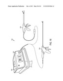 DEVICES AND TECHNIQUES FOR CUTTING AND COAGULATING TISSUE diagram and image