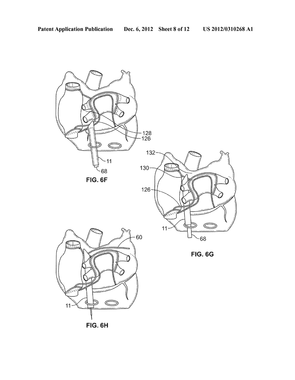 DISSECTING CANNULA AND METHODS OF USE THEREOF - diagram, schematic, and image 09