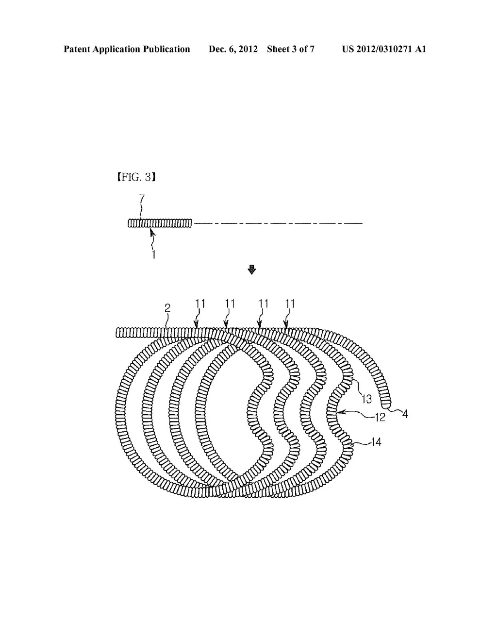 EMBOLUS-FORMING IN-VIVO INDWELLING COIL AND METHOD FOR MANUFACTURING AN     EMBOLUS-FORMING IN-VIVO INDWELLING COIL - diagram, schematic, and image 04