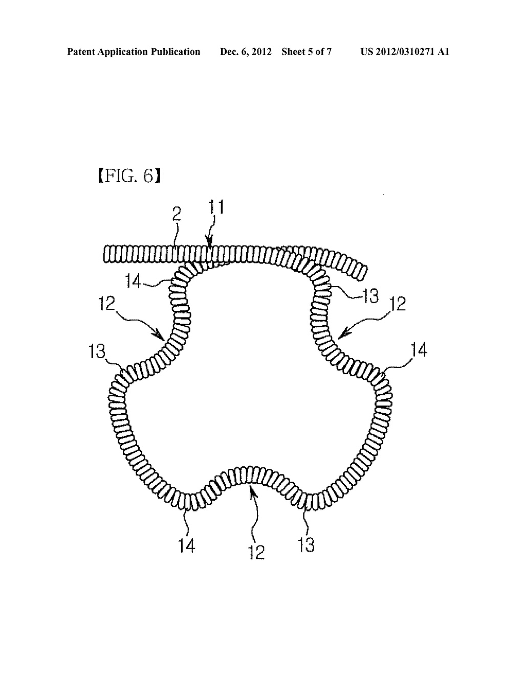 EMBOLUS-FORMING IN-VIVO INDWELLING COIL AND METHOD FOR MANUFACTURING AN     EMBOLUS-FORMING IN-VIVO INDWELLING COIL - diagram, schematic, and image 06