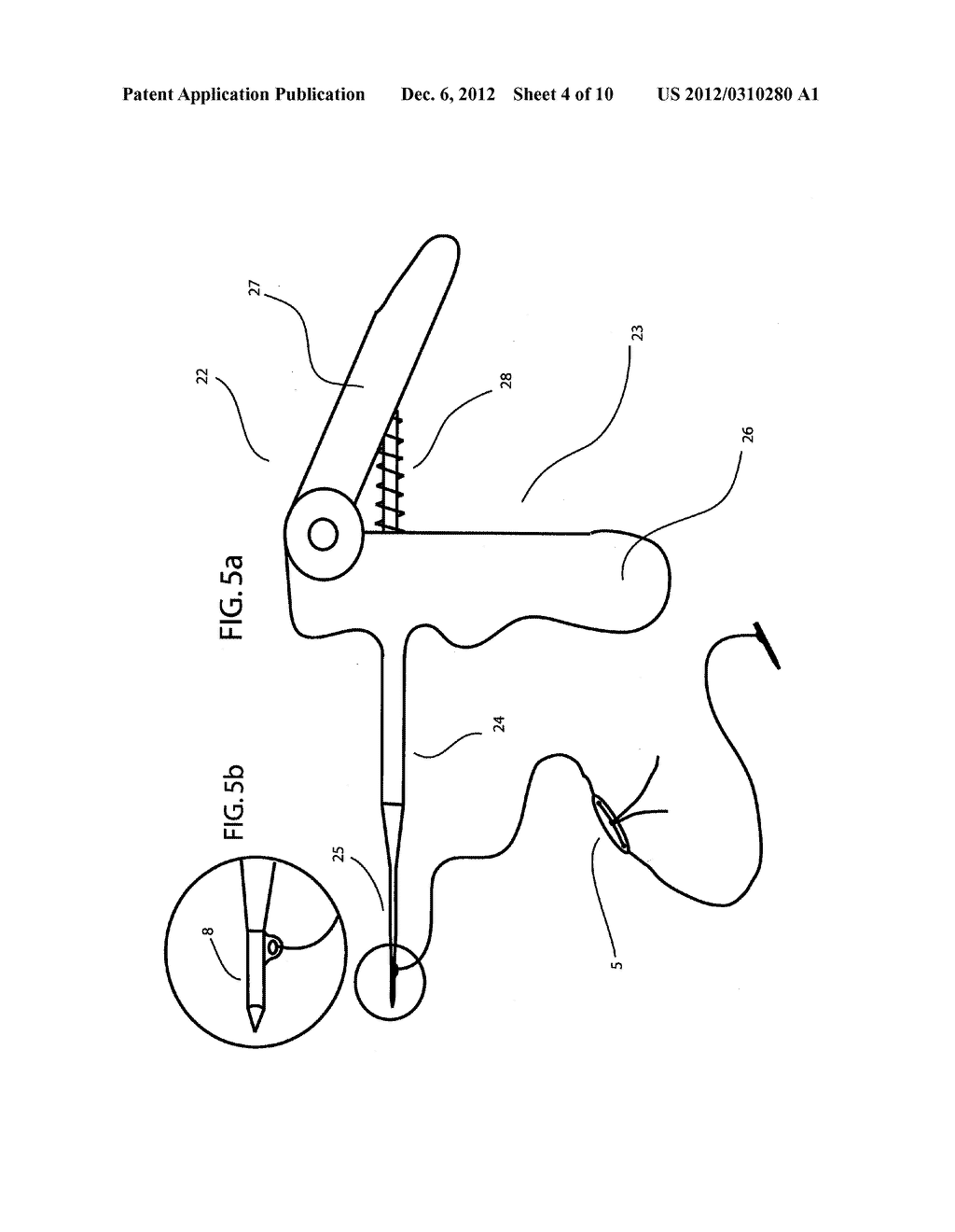 Device and Method for Nasal Surgery - diagram, schematic, and image 05