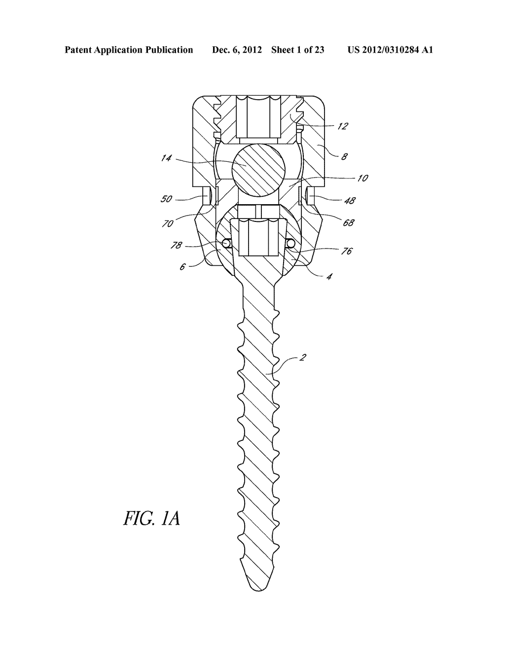 POLYAXIAL PEDICLE SCREW - diagram, schematic, and image 02