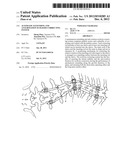 AUTOMATIC-EXTENDING AND ANTI-ROTATION SCOLIOSIS CORRECTING SYSTEM diagram and image