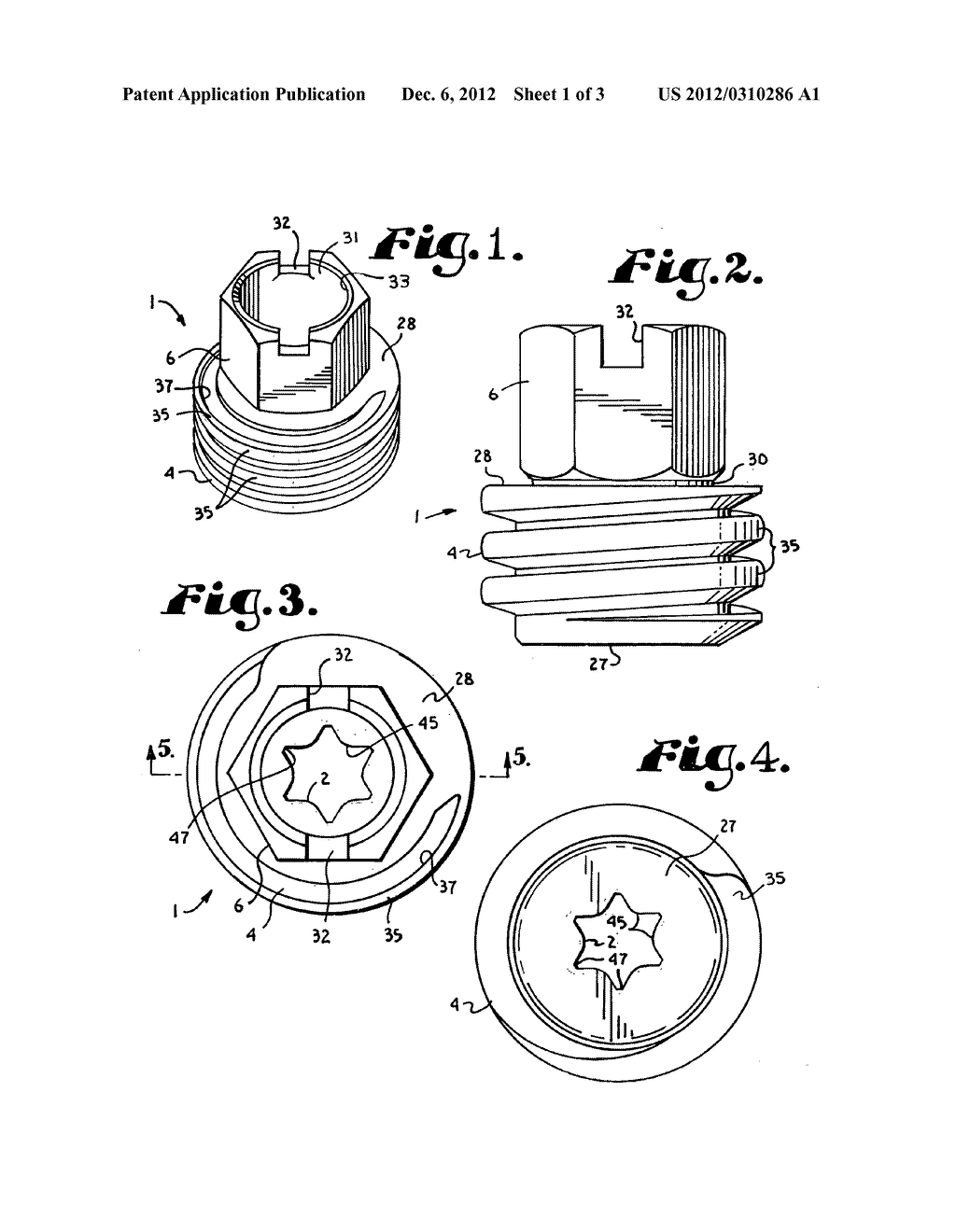 Anti-splay medical implant closure with multi-surface removal aperture - diagram, schematic, and image 02