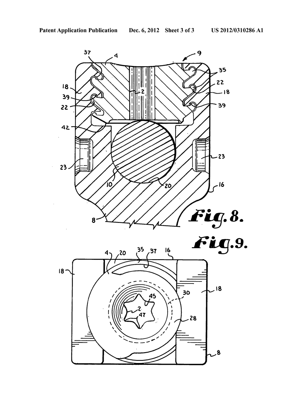 Anti-splay medical implant closure with multi-surface removal aperture - diagram, schematic, and image 04