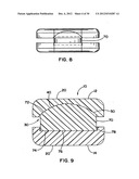 Artificial Disc Device diagram and image