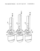 Artificial Disc Device diagram and image