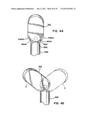 Artificial Disc Device diagram and image