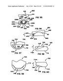 Artificial Disc Device diagram and image