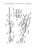 Artificial Disc Device diagram and image