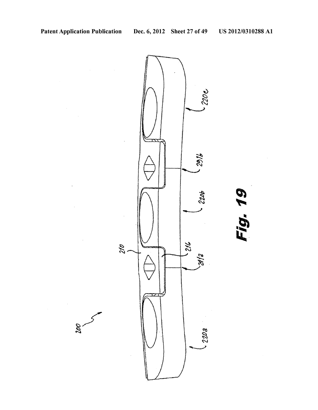 DYNAMIC VERTEBRAL COLUMN PLATE SYSTEM - diagram, schematic, and image 28