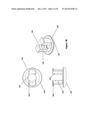 FLEXIBLE PLATE FIXATION OF BONE FRACTURES diagram and image