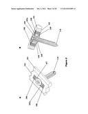 FLEXIBLE PLATE FIXATION OF BONE FRACTURES diagram and image