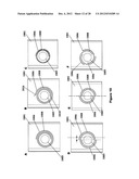 FLEXIBLE PLATE FIXATION OF BONE FRACTURES diagram and image