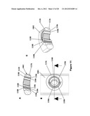 FLEXIBLE PLATE FIXATION OF BONE FRACTURES diagram and image