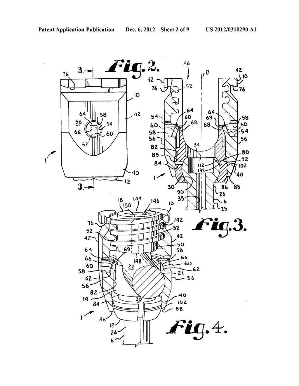 Polyaxial bone screw with spherical capture, compression insert and     alignment and retention structures - diagram, schematic, and image 03