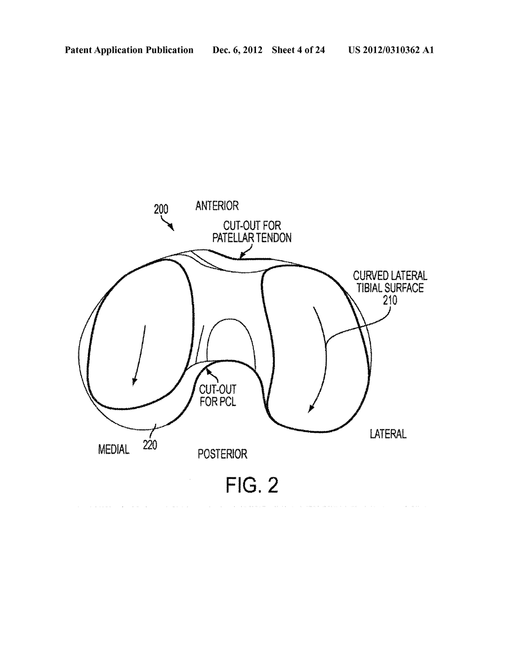 IMPLANT FOR RESTORING NORMAL RANGE FLEXION AND KINEMATICS OF THE KNEE - diagram, schematic, and image 05