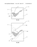 PATIENT-SPECIFIC MANUFACTURING OF POROUS METAL PROSTHESES diagram and image